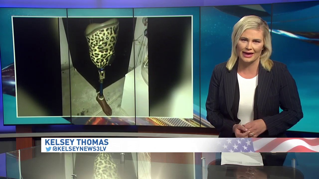 'There's a leg in my garbage can!' - Woman finds lost limb in the trash