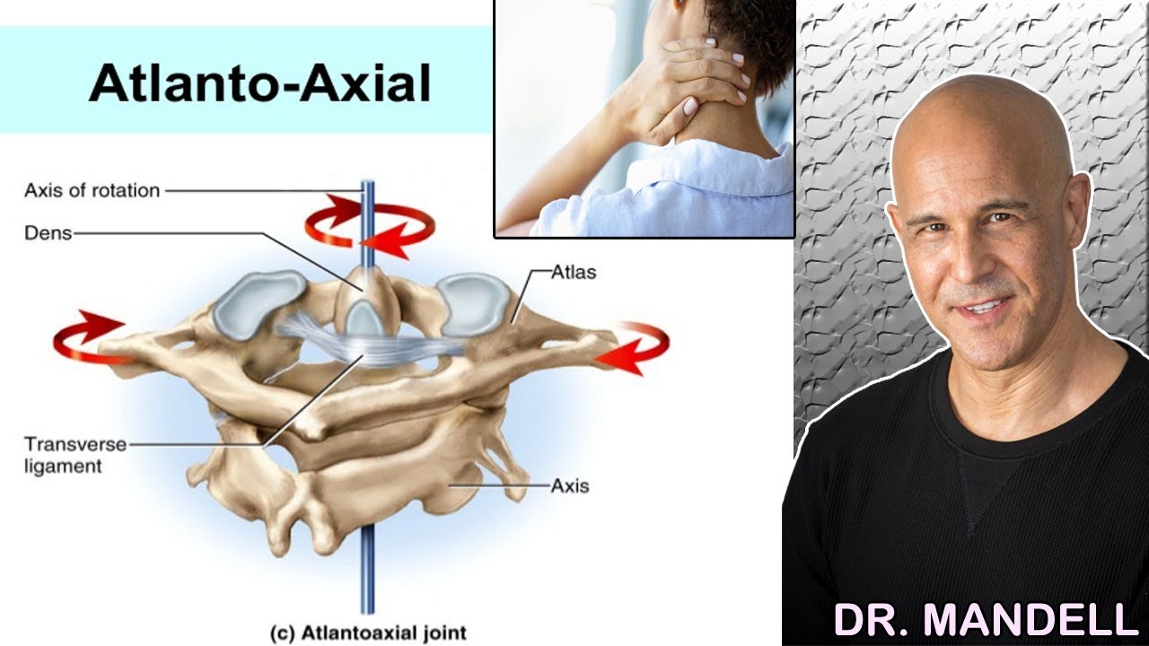 WHY YOUR NECK KEEPS LOCKING UP ... FIX THE CRICK  (ATLAS-AXIS JAMMING)  -  Dr Alan Mandell, DC
