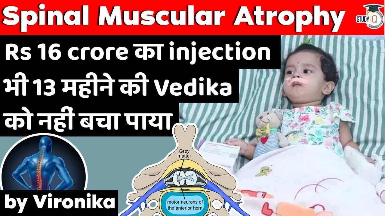 Spinal Muscular Atrophy disease - World's costliest injection failed in saving life of Vedika | MPSC