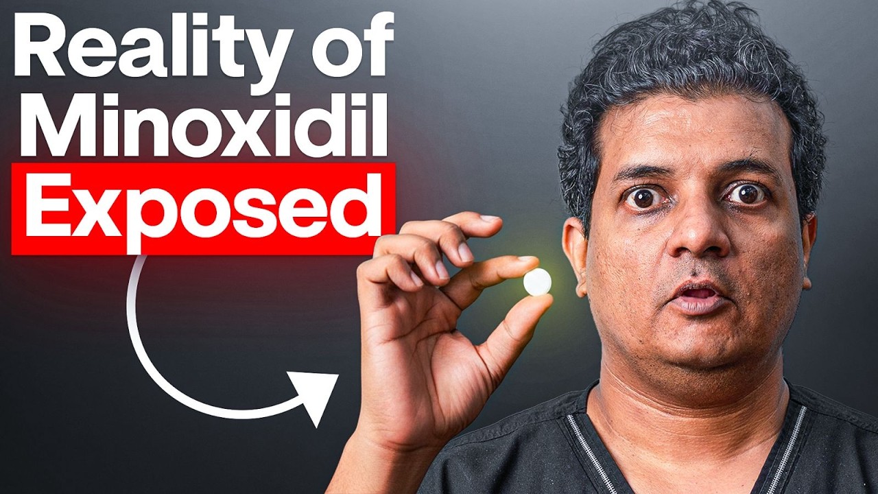 Why Minoxidil Causes Increased Hairfall | Side Effects & Shocking Facts