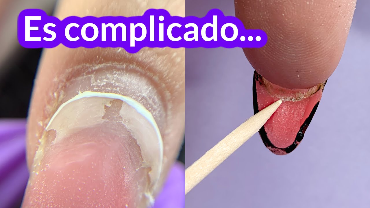RETOQUE de UÑAS Extremo: Limpieza Debajo de la UÑA, LEVANTAMIENTO