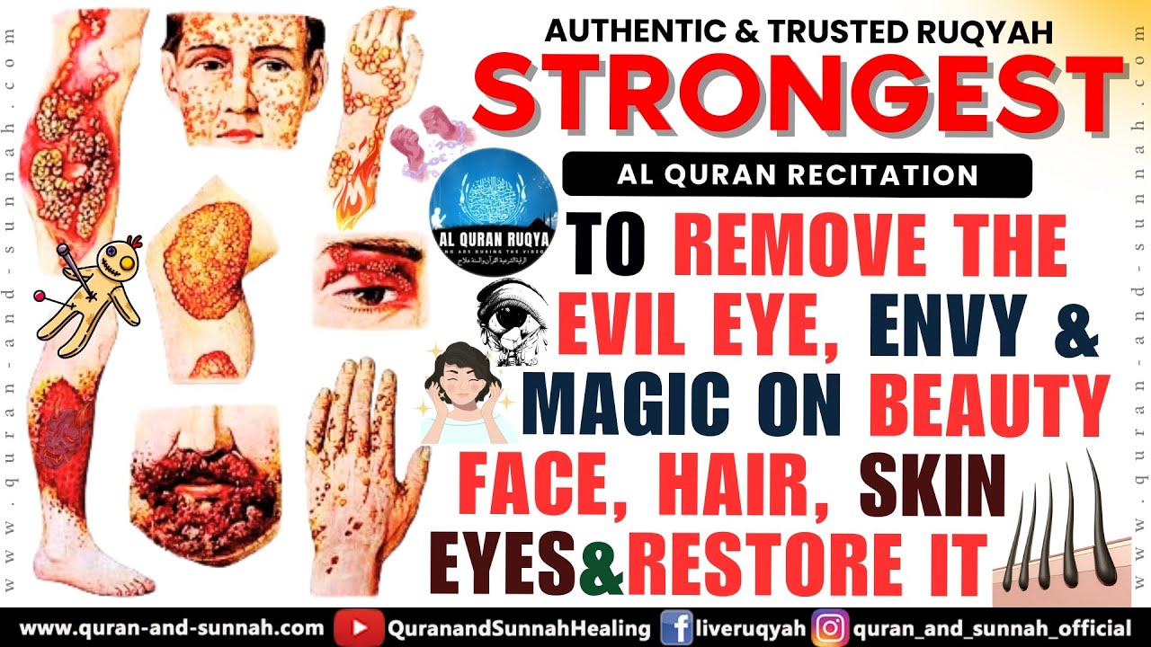 AL QURAN RUQYAH TO REMOVE THE EVIL EYE, ENVY & MAGIC ON BEAUTY, FACE, HAIR, SKIN, EYES & RESTORE IT.