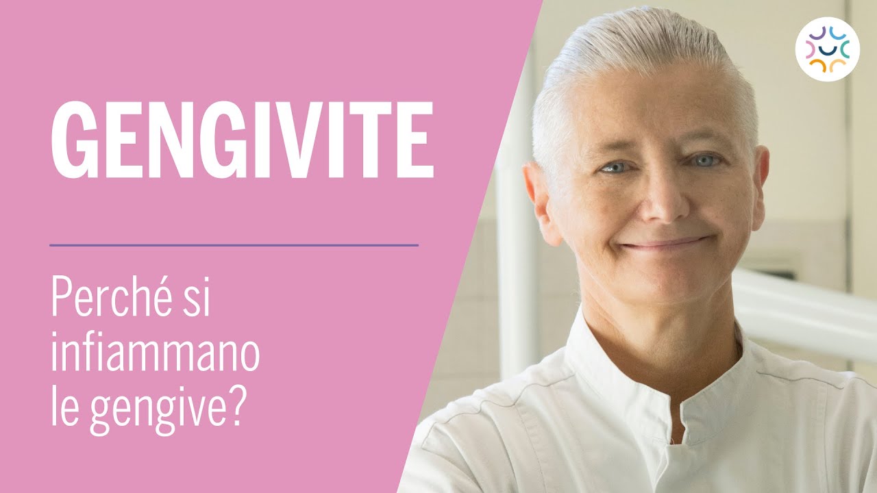 Gengive Infiammate e gonfie❓👉Quali sono le cause e i fattori di rischio della GENGIVITE❓
