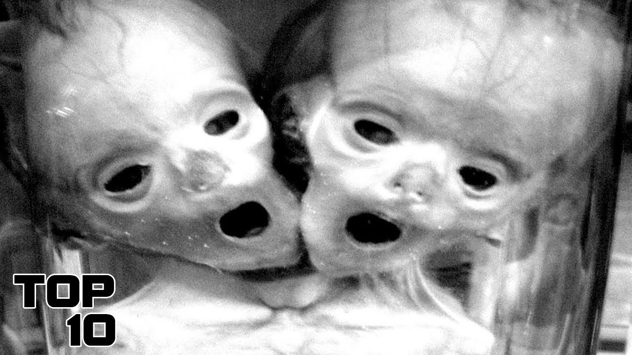 Top 10 EVIL Human Experiments Performed By Mad Scientists