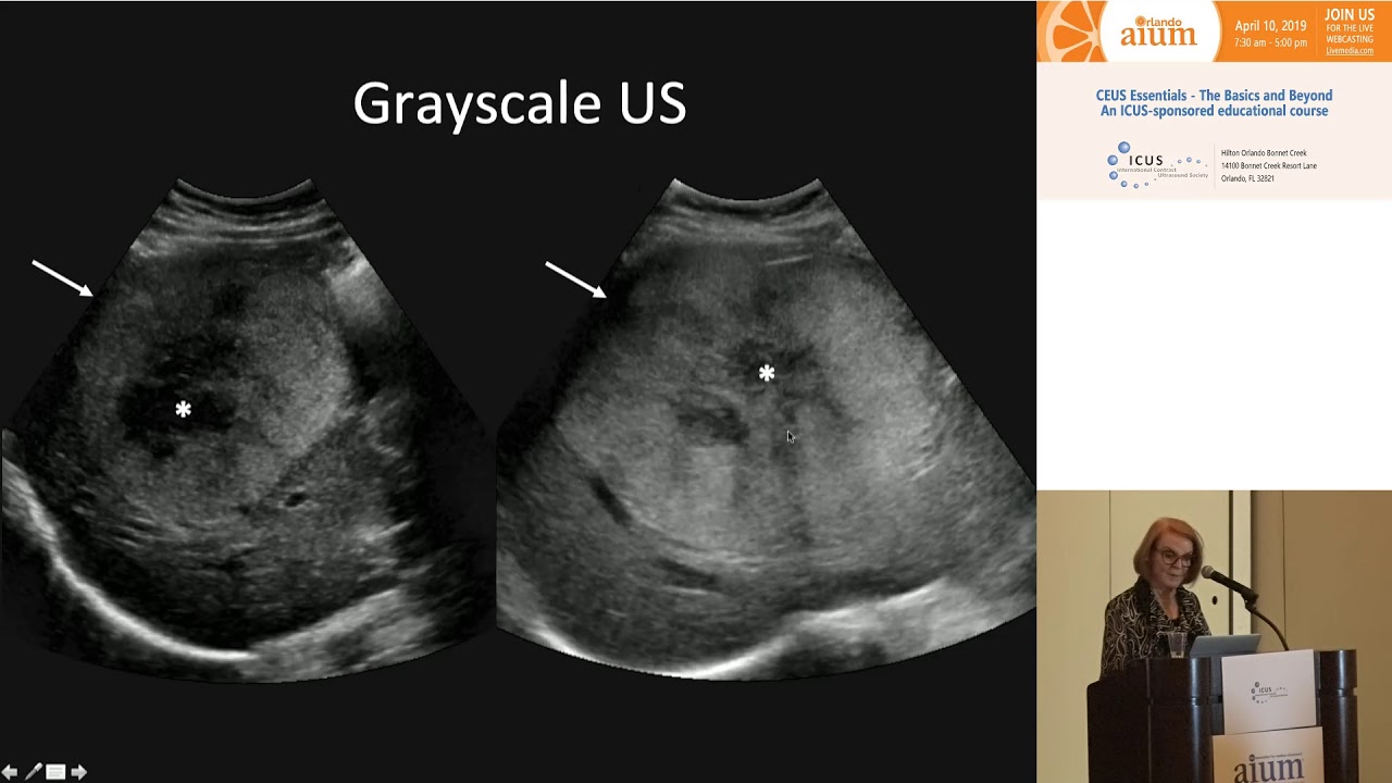 Unknown liver cases