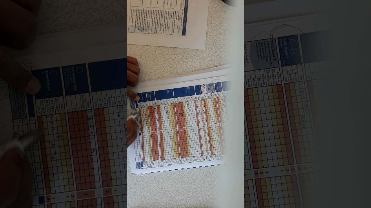 News2 Chart Documentation/Osce exam for nurses/ New test of competence/Osce2022