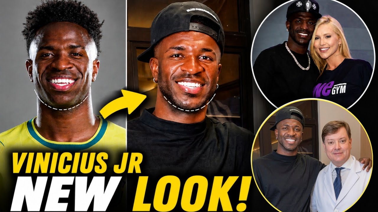 😱 Vinicius Jr's New Face Has Everyone Talking After Chin Surgery!