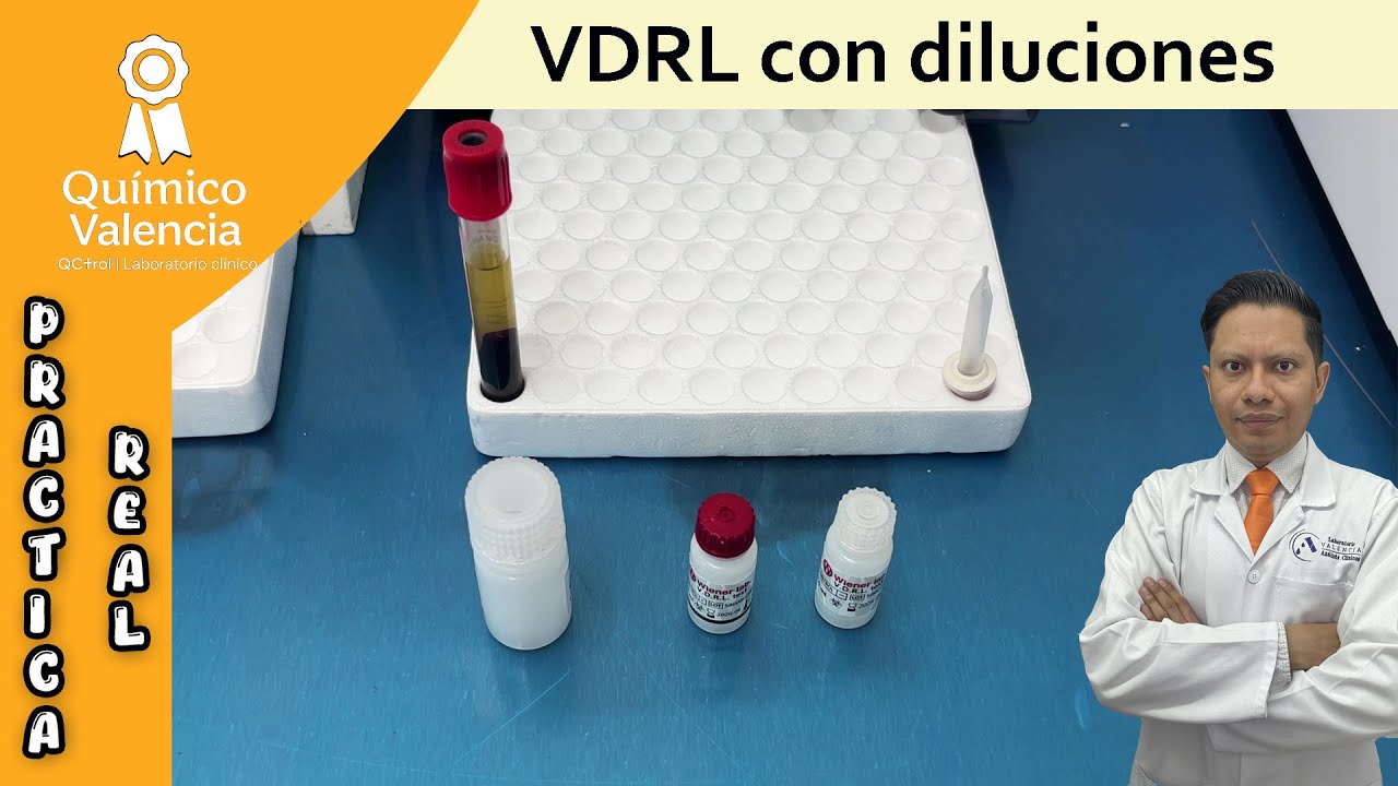 Тест VDRL на сифилис 🔬 Фактическая процедура, считывание и интерпретация результатов.