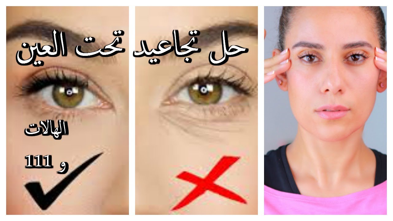 مساج العين لشد تجاعيد حول العين ورفعها و علاج الهالات بدون جراحه ولا تكاليف