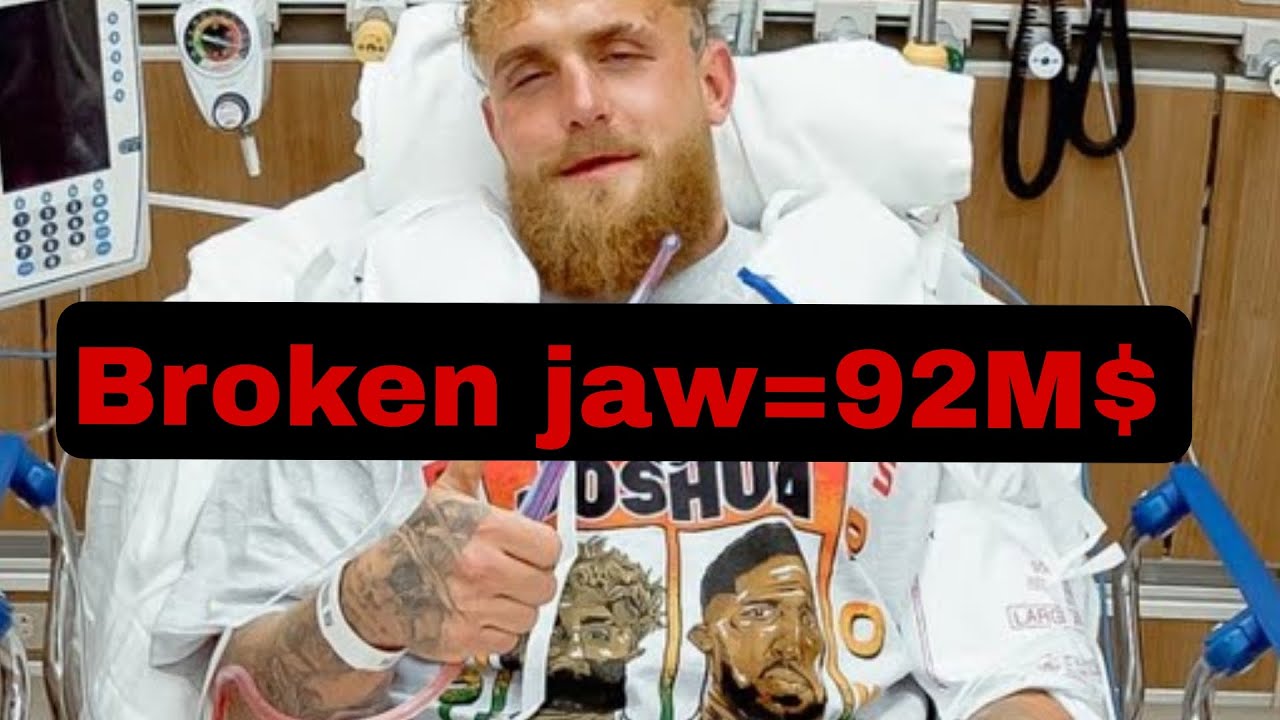 Would You Break Your Jaw for $92 Million?