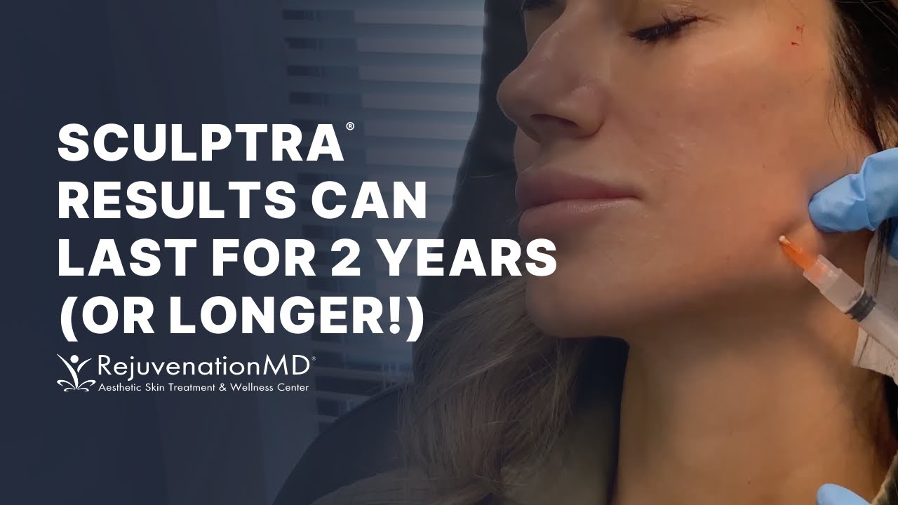 Sculptra Filler for Beautiful, Natural, Long-Lasting Results