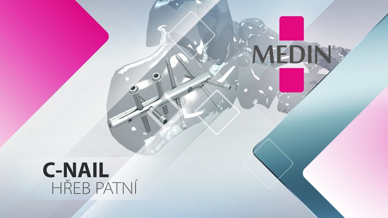 C-NAIL operačn&iacute; technika