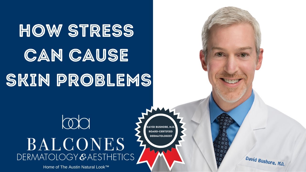 How Stress Can Cause Skin Problems | David Bushore, M.D. | Austin, TX | Ph: 512-459-4869