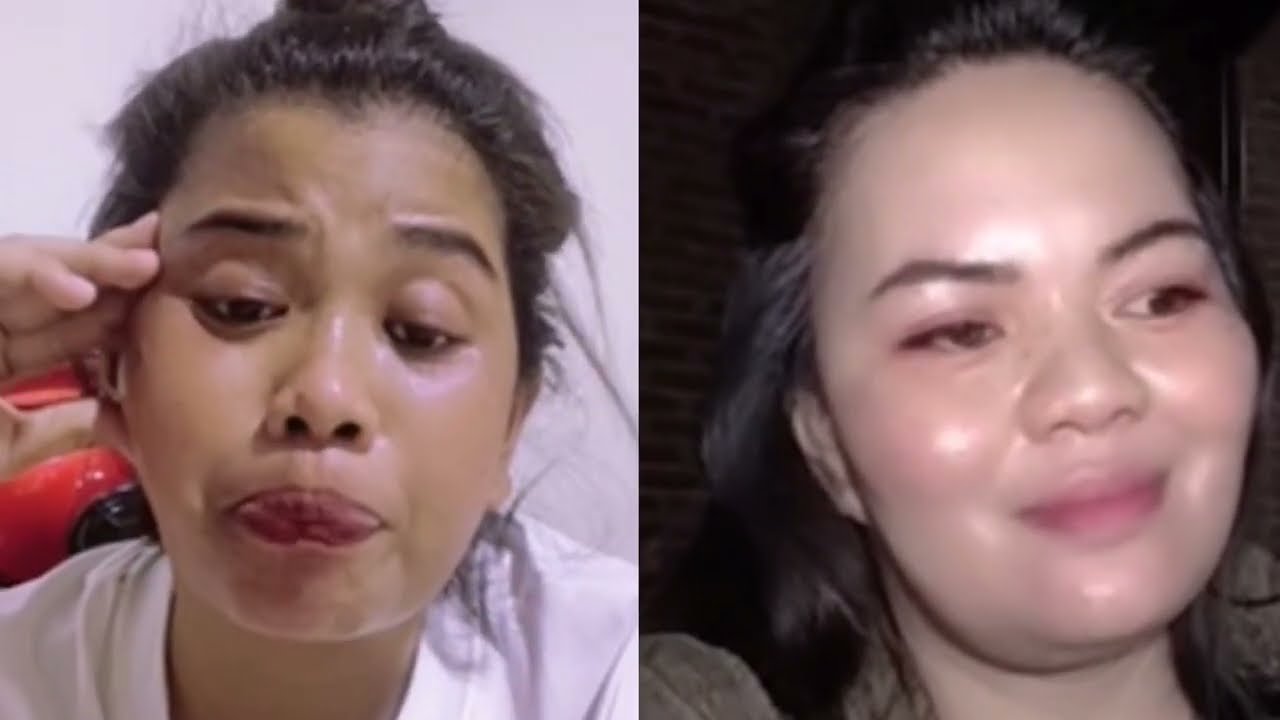 Jadi Korban TokTok, kenal di Toktok