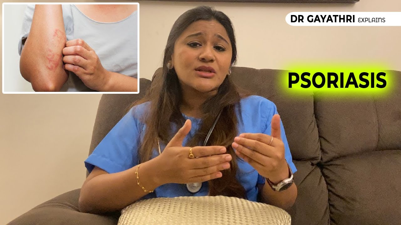 Psoriasis - Skin Care Treatment - Dr Gayathri Rajesh - Best Dermatologist in Chennai