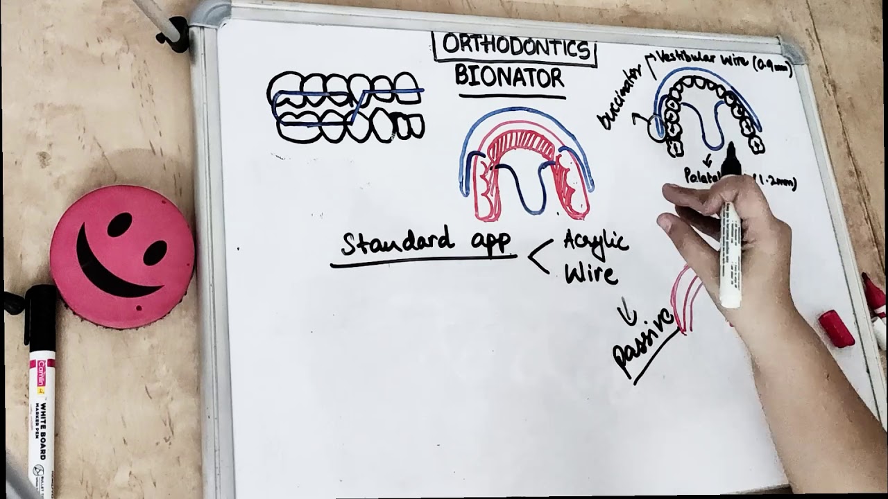 bionator appliance in orthodontics I dental lectures