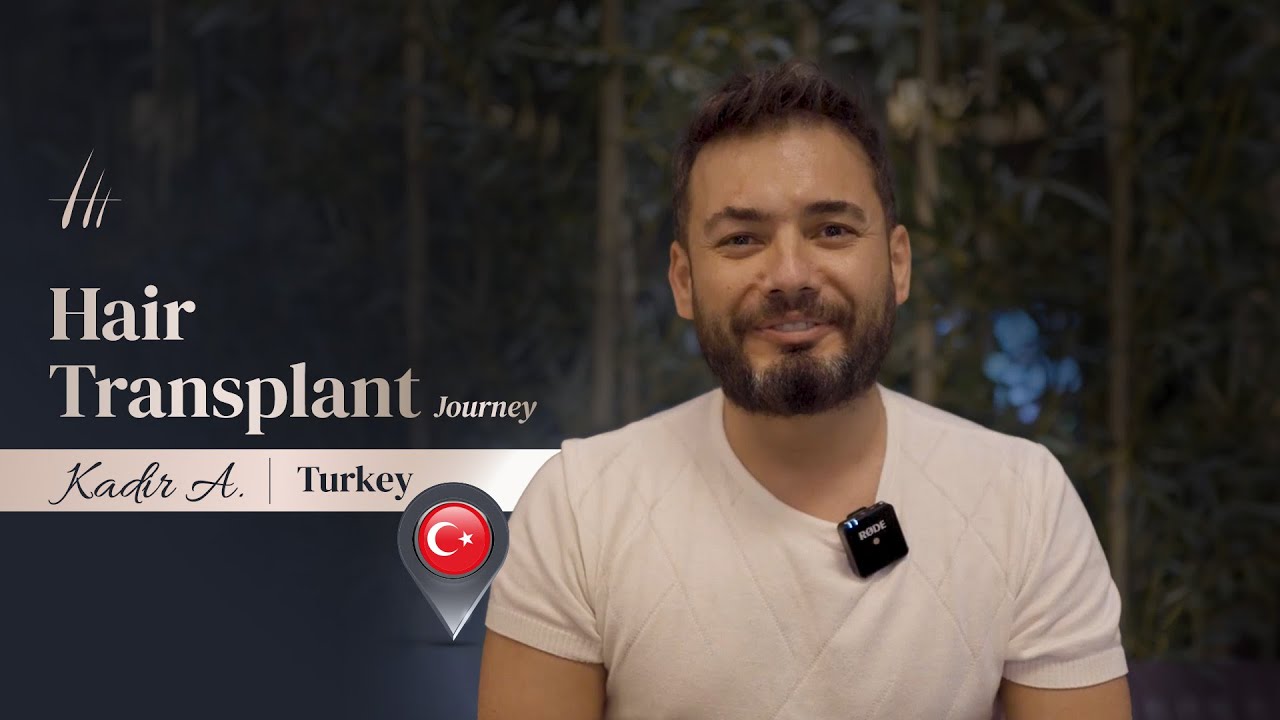 Kadir Alkan&rsquo;s Hair Transplant Journey