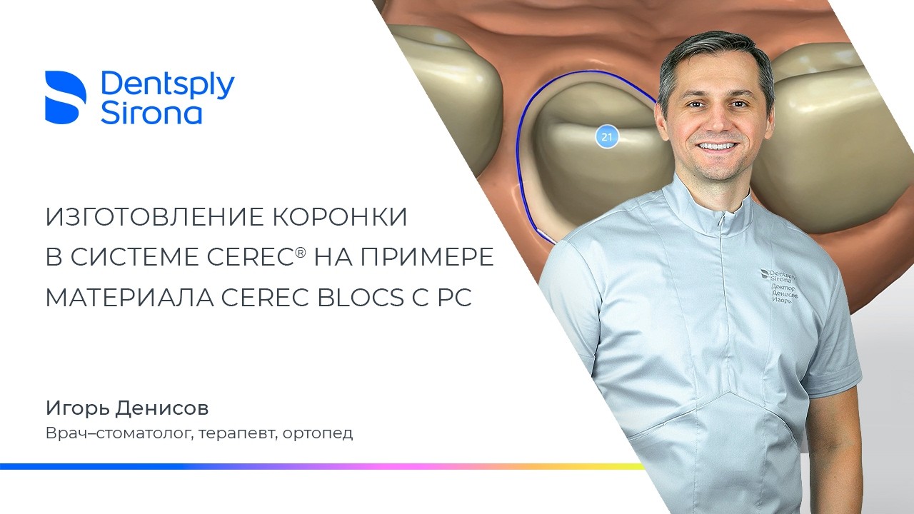 Изготовление коронки в системе CEREC на примере материала CEREC Blocs C PC