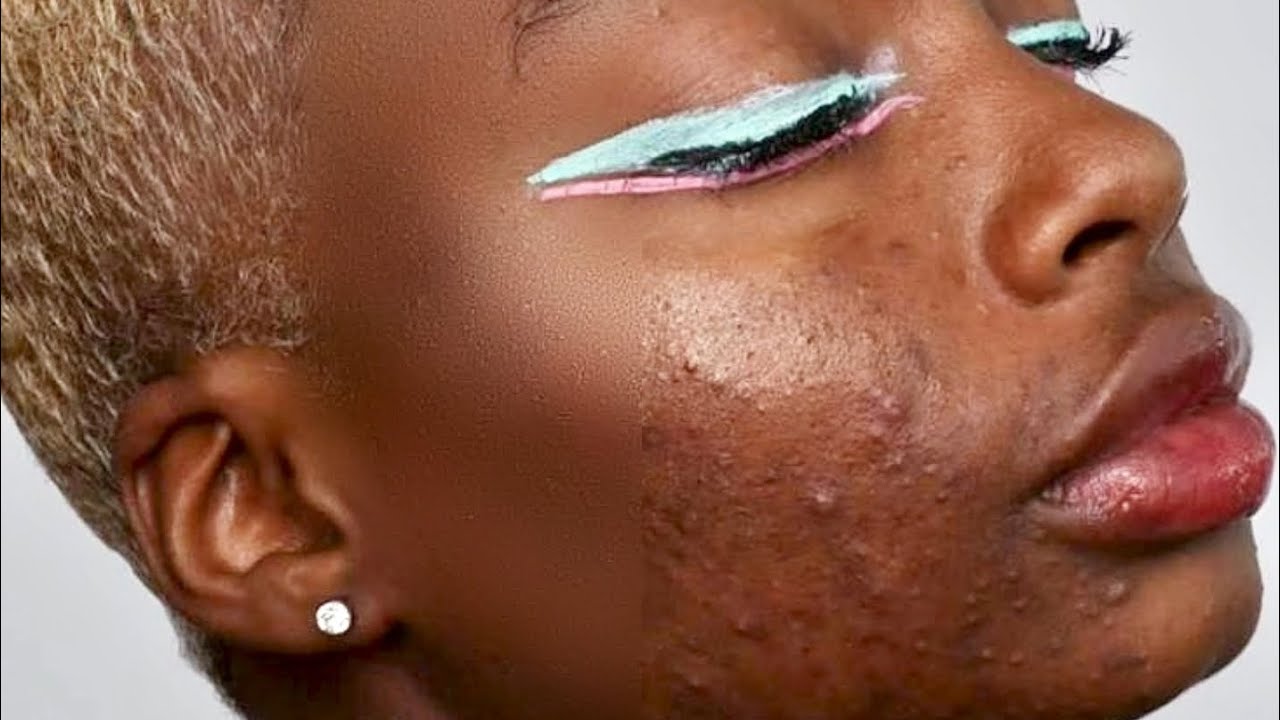 How to skin retouch smartly using Photoshop | 