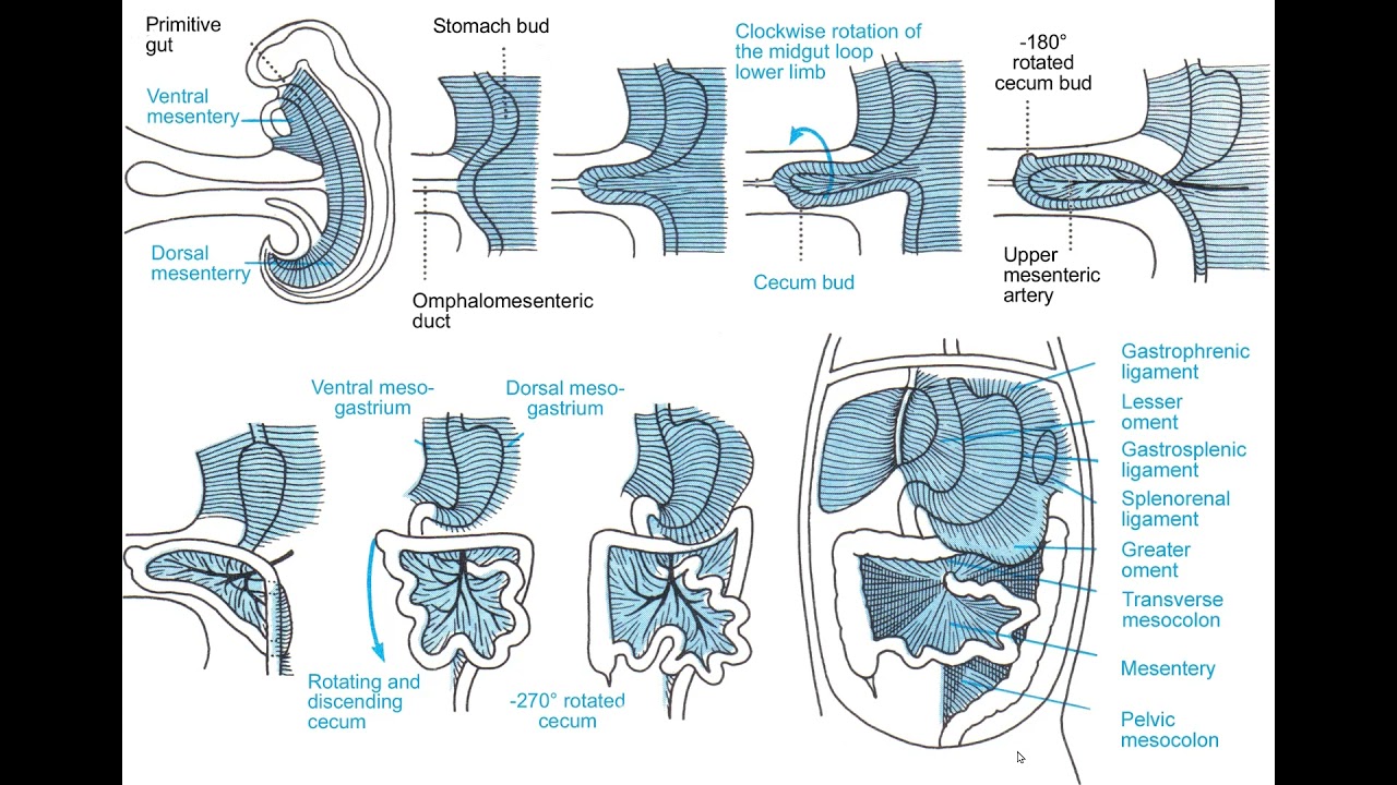 Má rotação intestinal