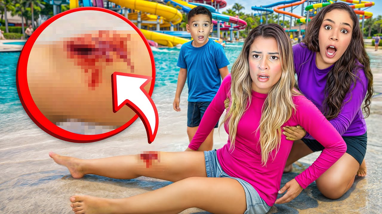 YASZOCA TEVE UM ACIDENTE NA PISCINA *Doeu muito 😭