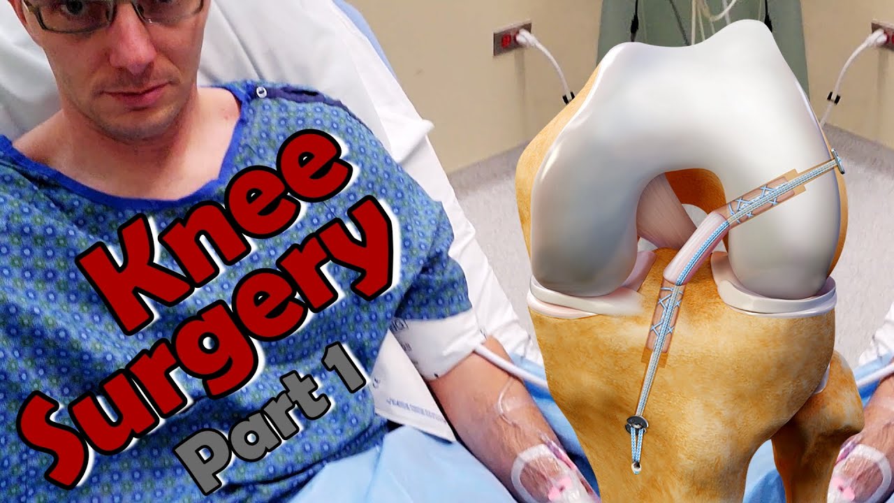 Climber Knee Surgery - Part 1