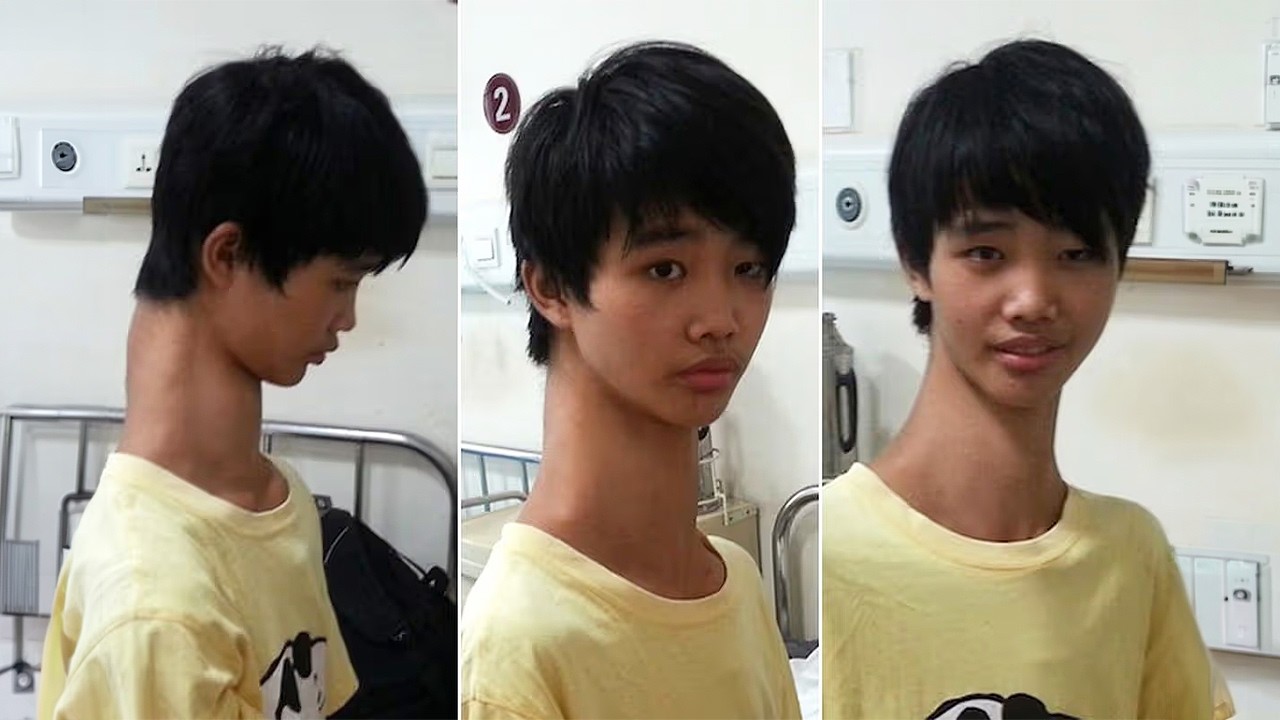 Most Unusual Teenagers