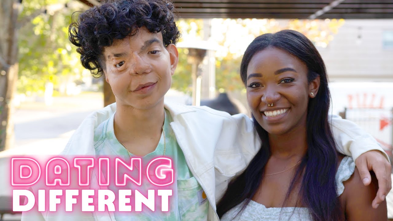 How Will My Blind Date React To My Facial Difference? | DATING DIFFERENT