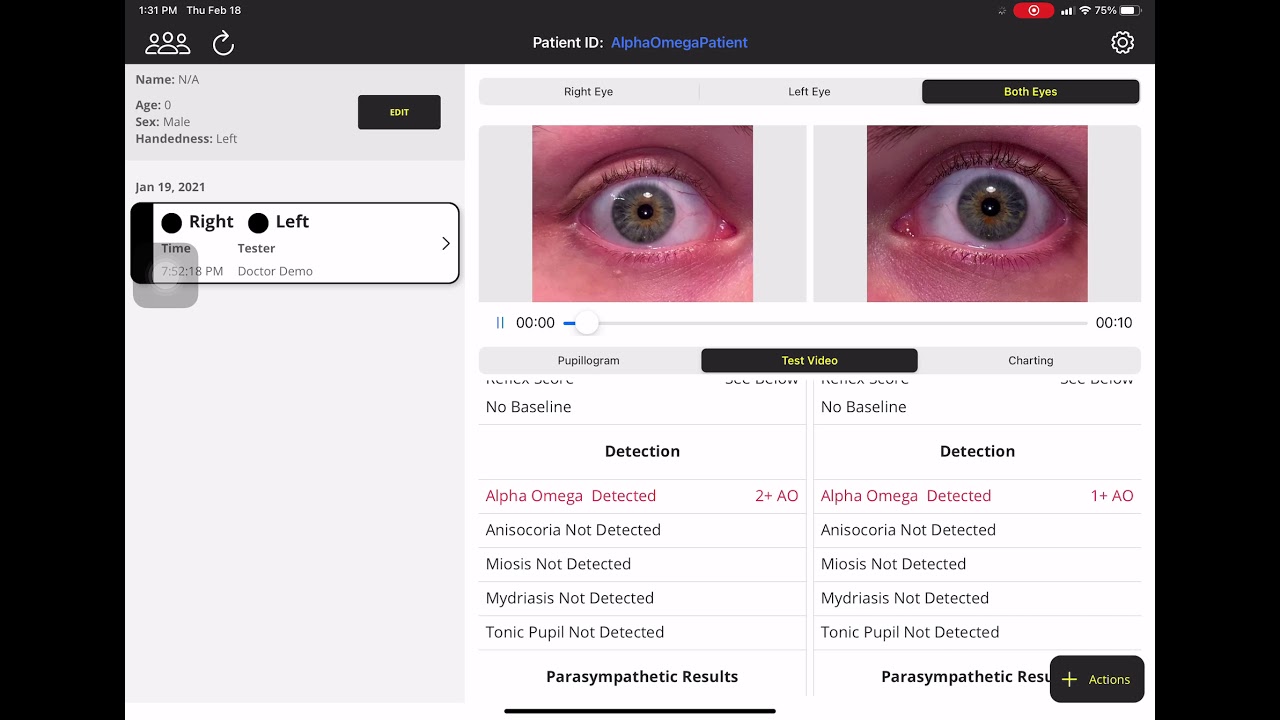 Reflex Pro: Alpha Omega pupil detection