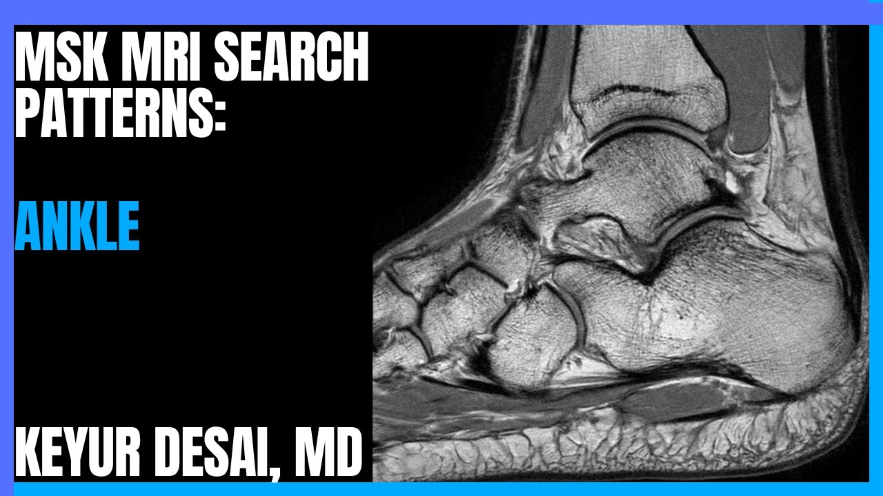 MSK MRI Search Patterns from Dr. Keyur Desai: Ankle