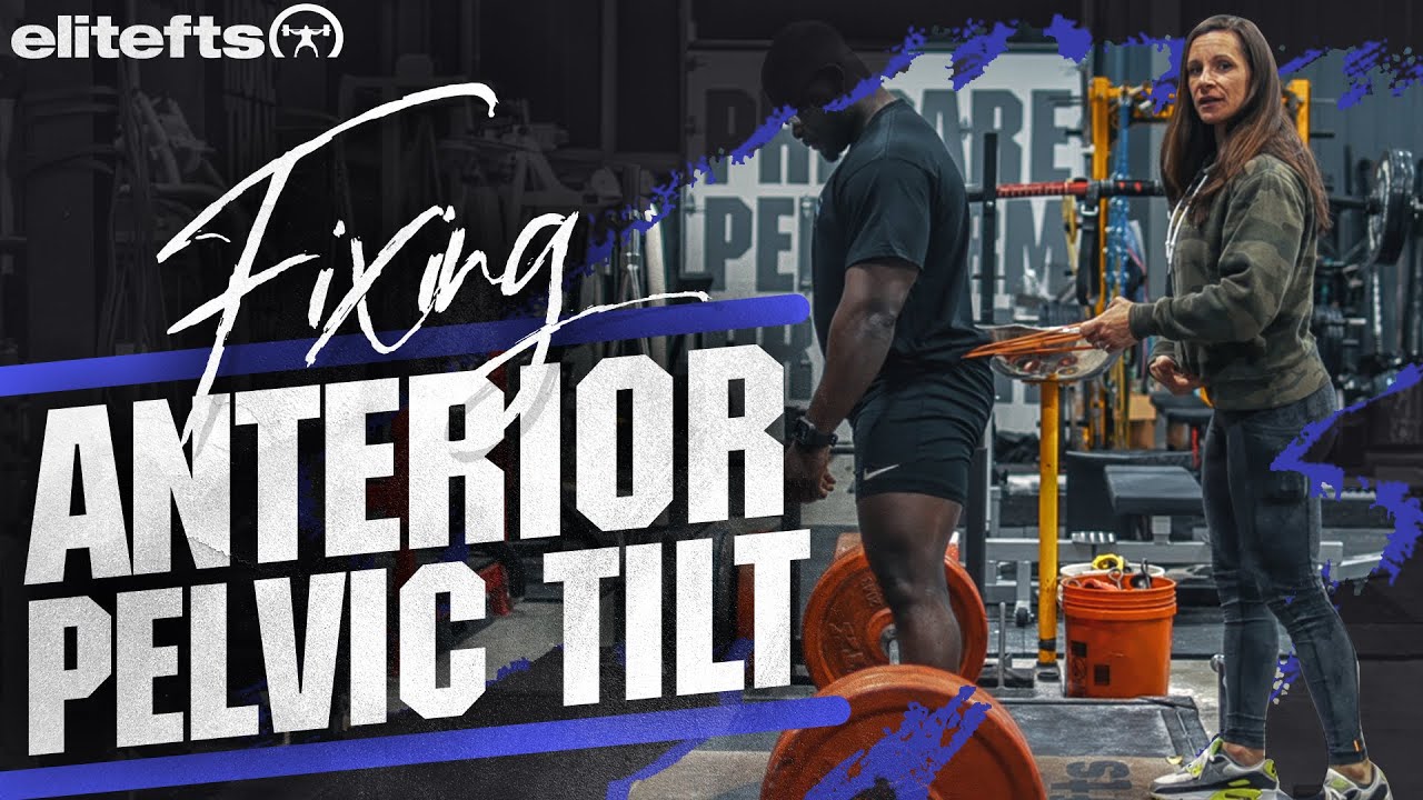Correcting Anterior Pelvic Tilt in the Deadlift