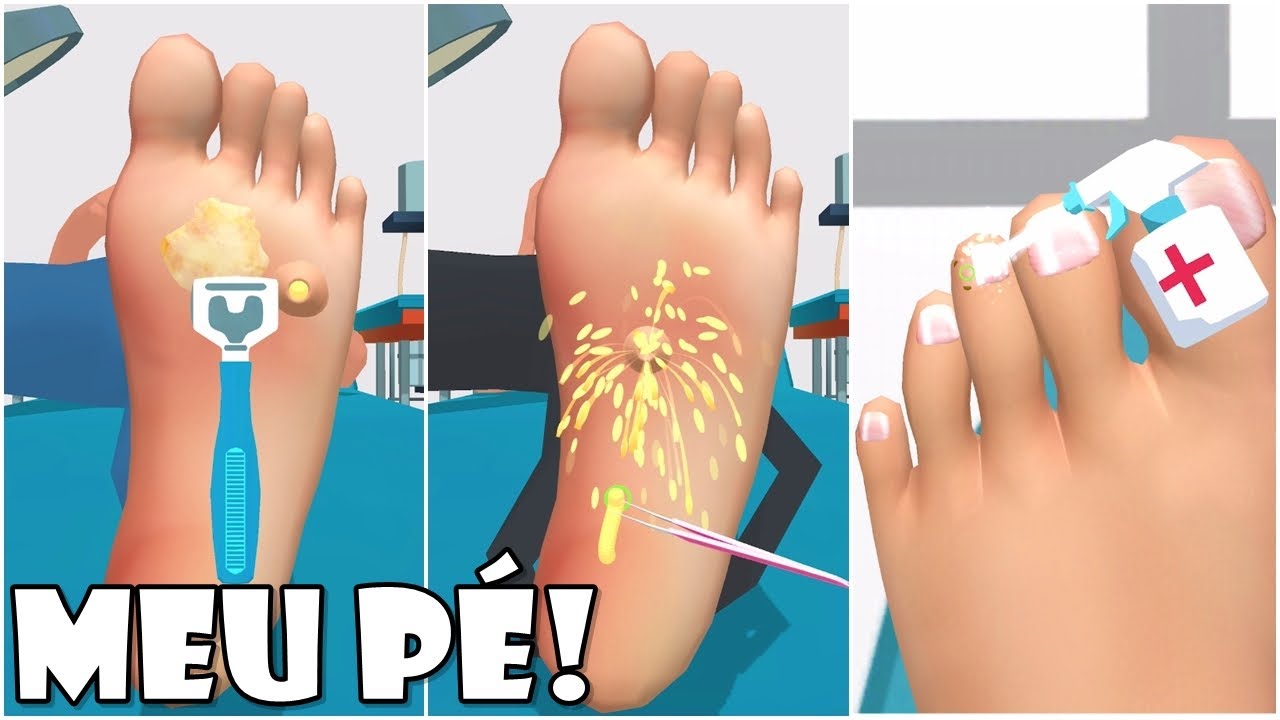 Viramos Cutucadores De Pé na Clínica De Pés