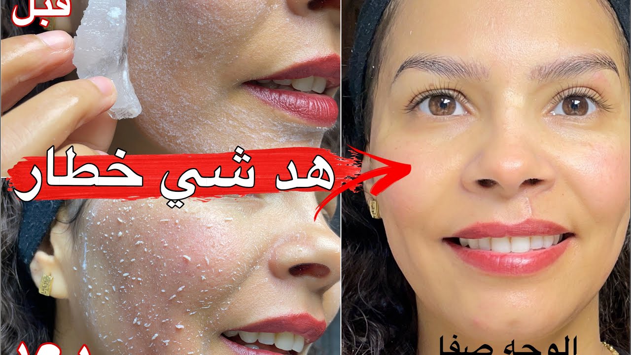 عتقوا الوصفة التي يبحث عنها الملايين من النساء😍الخيال العلمي🫨الوجه تقشر ودا معاه الكلف وزروگية سنين 