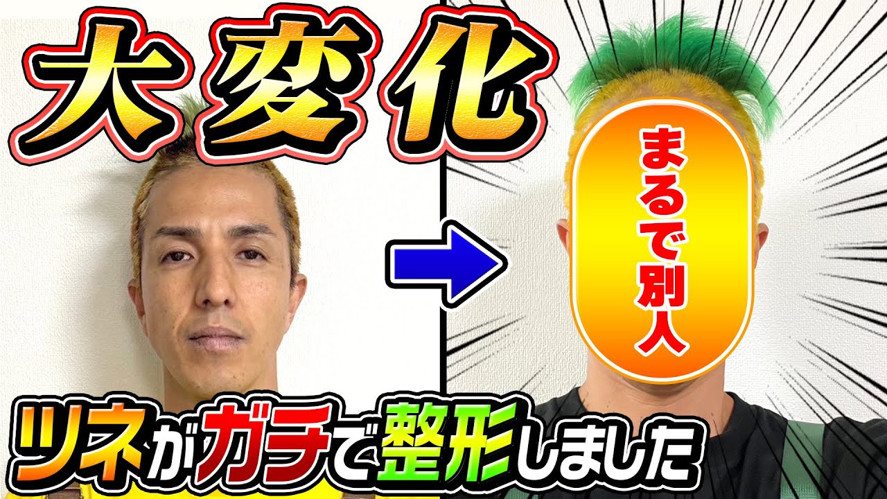 【大変化】ツネがガチで整形しました