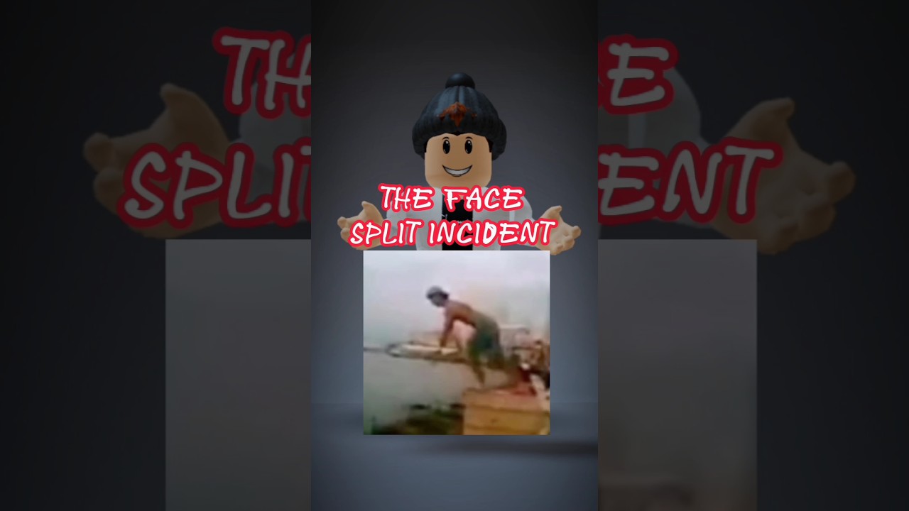 The Story Behind The Face Split Incident #shorts