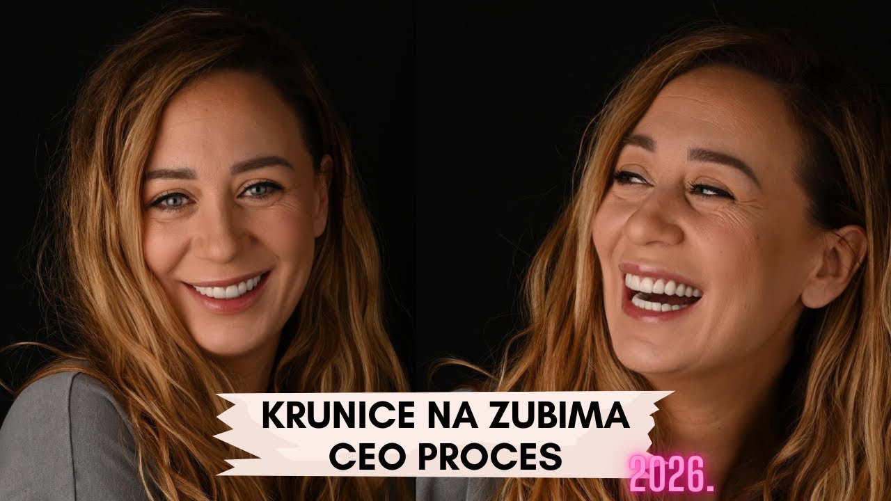 KRUNICE NA ZUBIMA - Kompletna procedura! 🤓