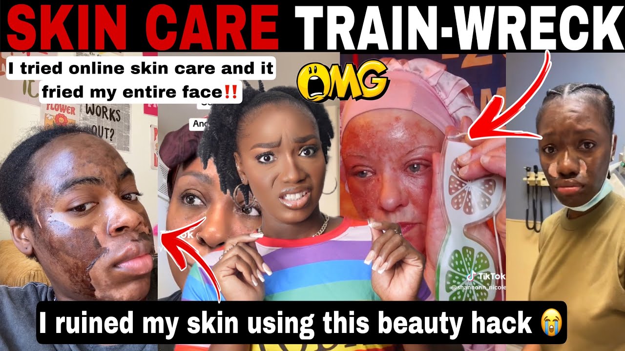MERCY!😱 SKIN CARE GONE WRONG! MUST WATCH SKIN CARE DISASTERS | BEAUTY HACKS GONE WRONG | TIKTOK COMP