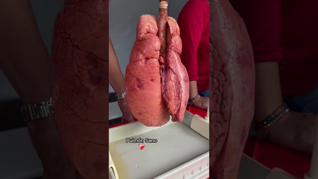 C&oacute;mo es el #pulm&oacute;n de un #fumador#curiosidades #sabiasque