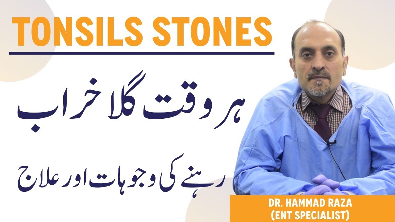 Tonsil Stones In Throat Urdu/Hindi - Gale Mein Pathri Kyun Hoti Hai - Tonsil Stone Ki Wajah Aur Ilaj