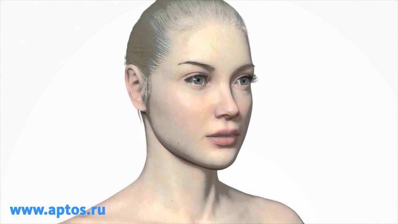 Aptos Threads Excellence, new methods of plastic surgery, Minimally invasive