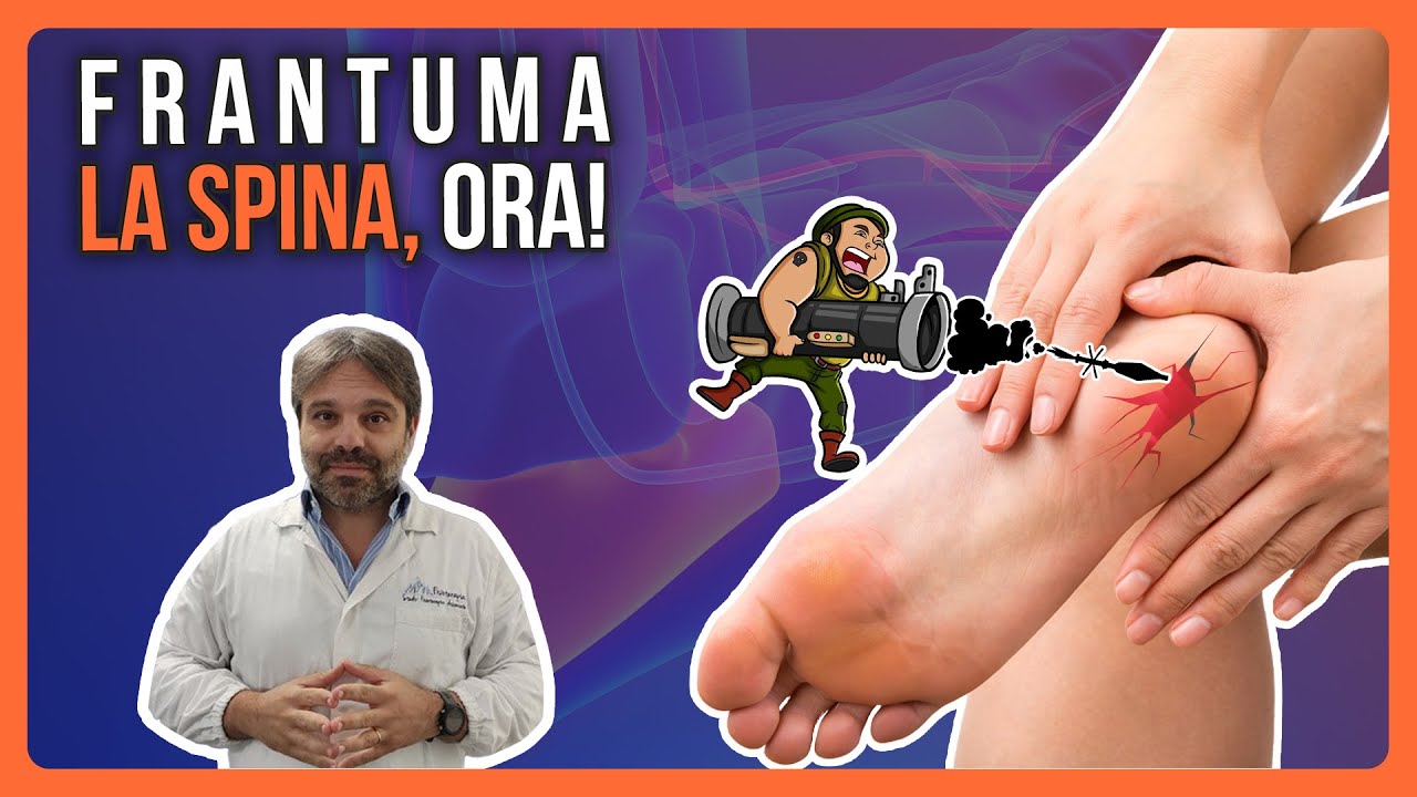 OPERAZIONE SPINA CALCANEARE: Voglio FRANTUMARE la SPINA ORA!!!