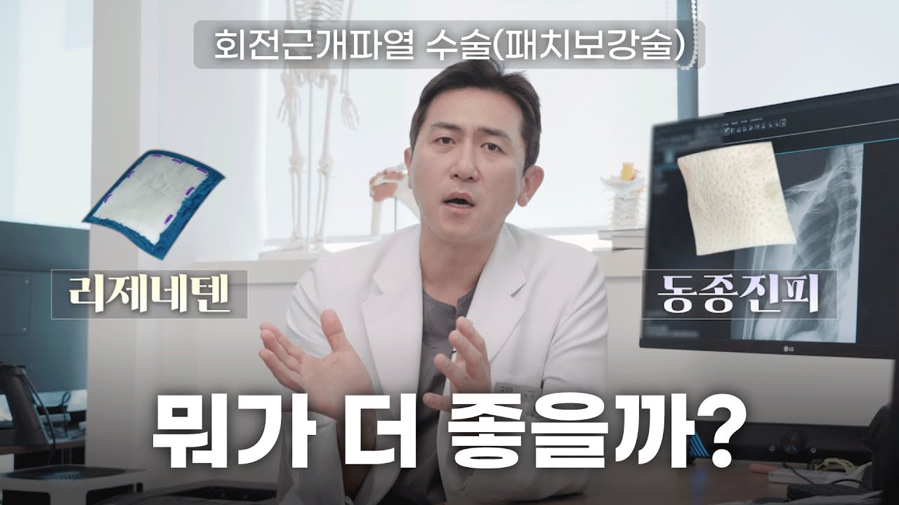 어깨 회전근개파열 수술, 리제네텐 VS 동종진피ㅣ210정형외과 최준하 대표원장
