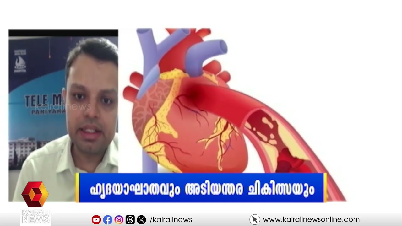ഹൃദയാഘാതവും അടിയന്തര ചികിത്സയും; ഹലോ ഡോക്ടറിൽ സംശയങ്ങൾക്ക് മറുപടിയുമായിഡോ. രാകേഷ് കെ | HELLO DOCTOR