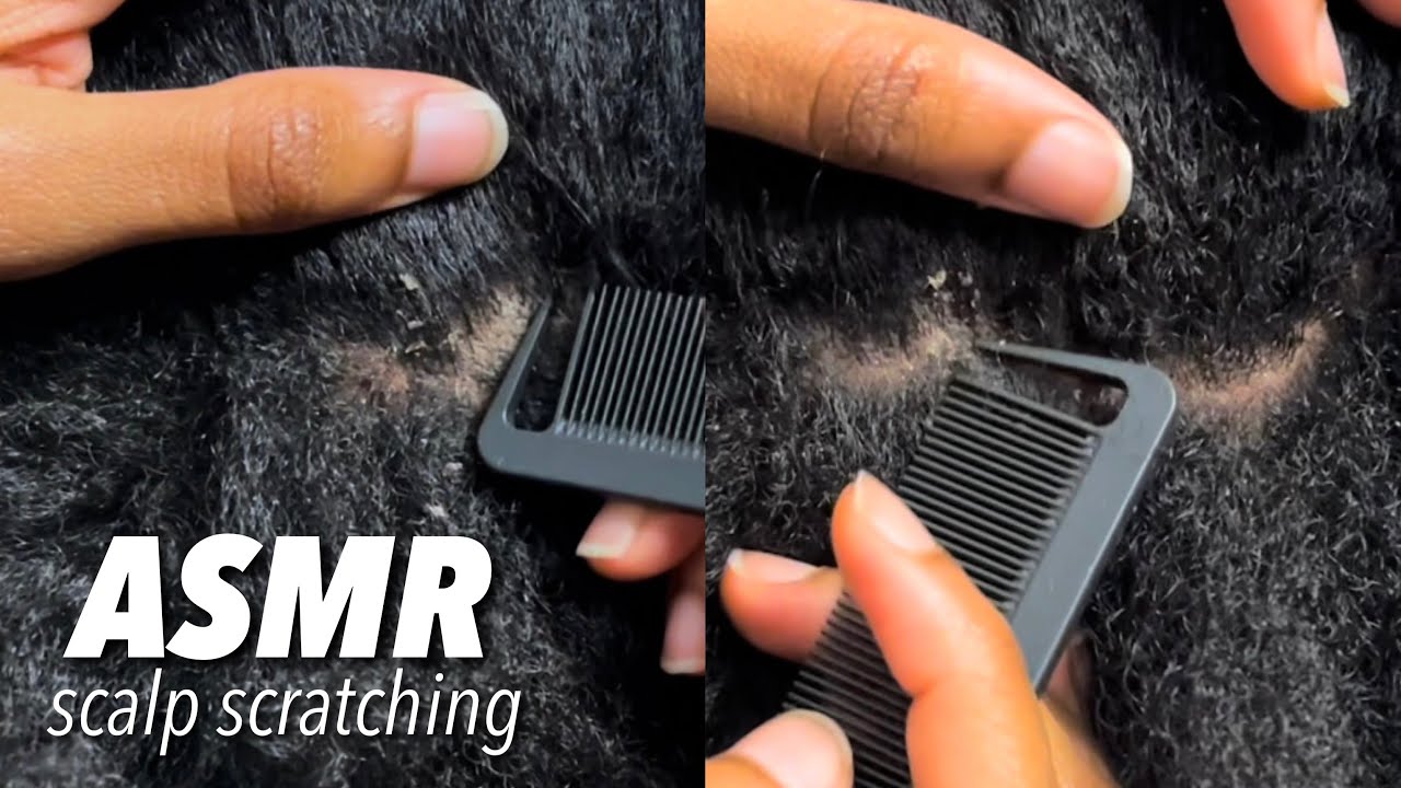 ASMR Scalp Scratching to help you relax💆🏽‍♀️✨