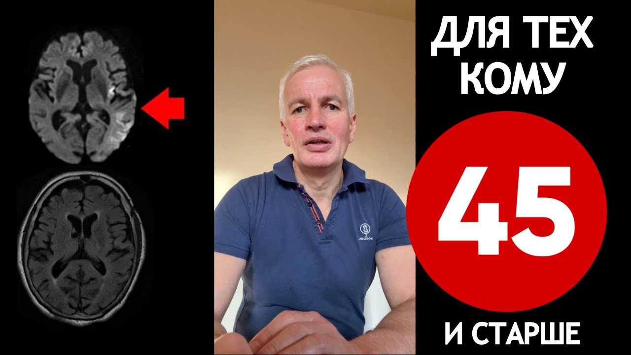 Для тех кому 45 лет и старше. Инсульт Блог.