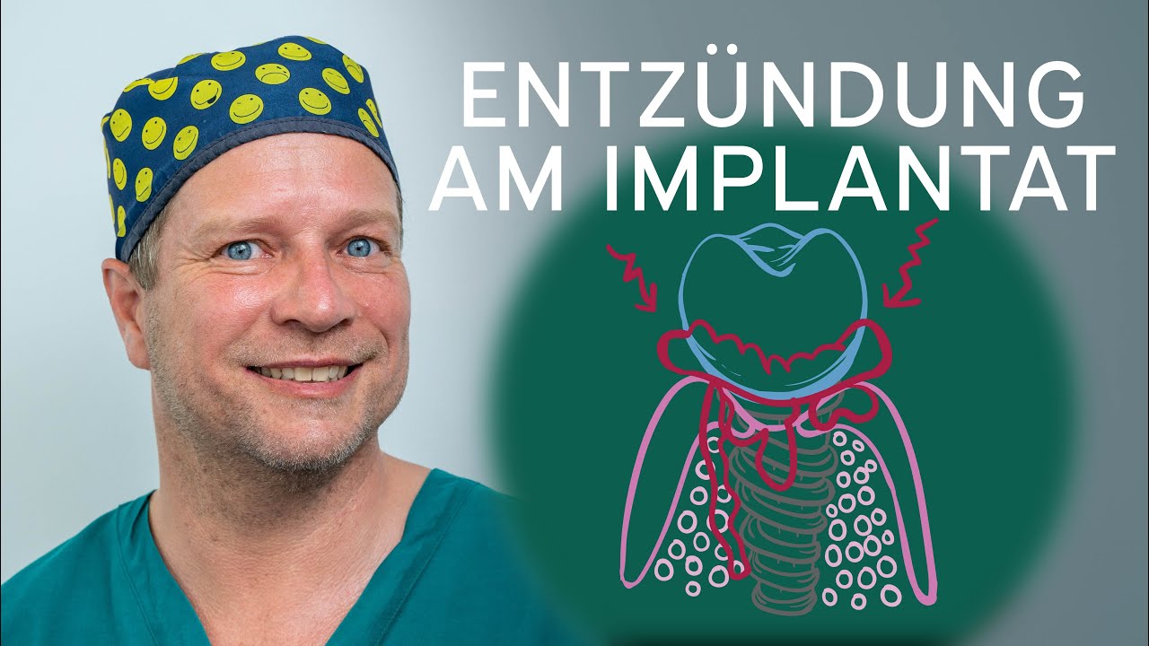 Entzündung am Implantat (Oralchirurgie)