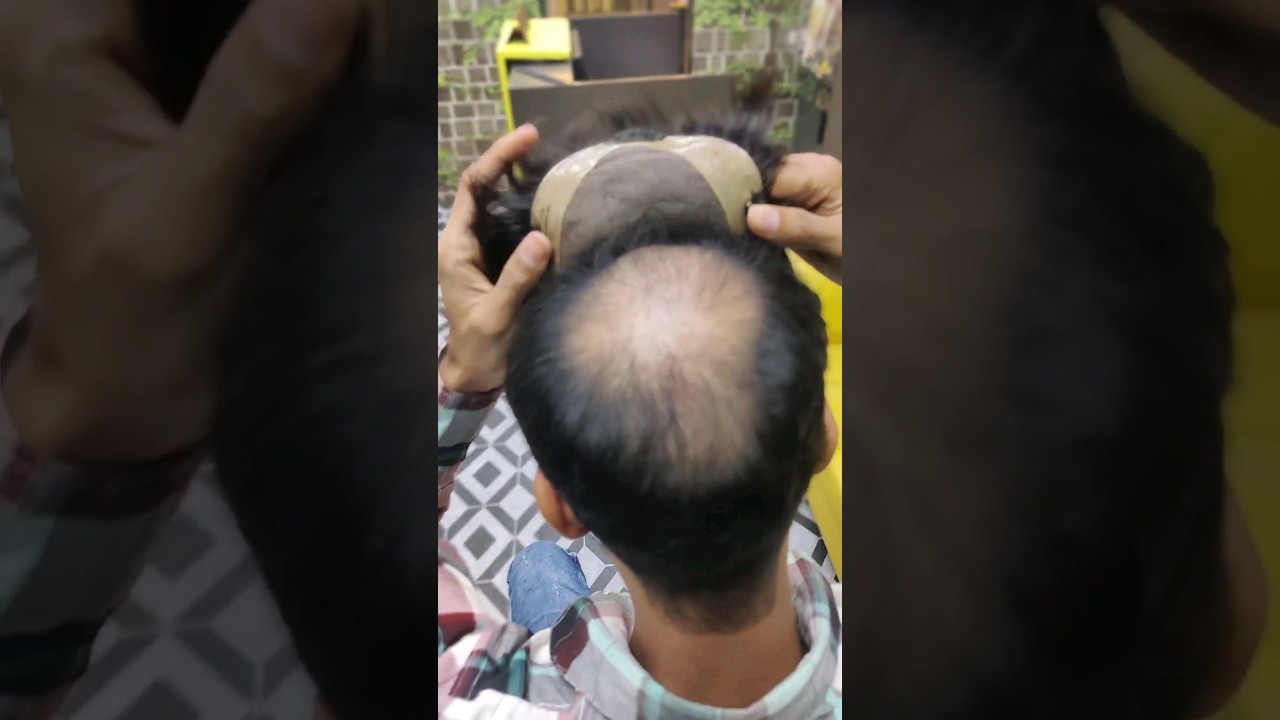 Best Clipping Hair Patch System | Delhihairfixing #hairpatch #hairtransplant #hairtechniques