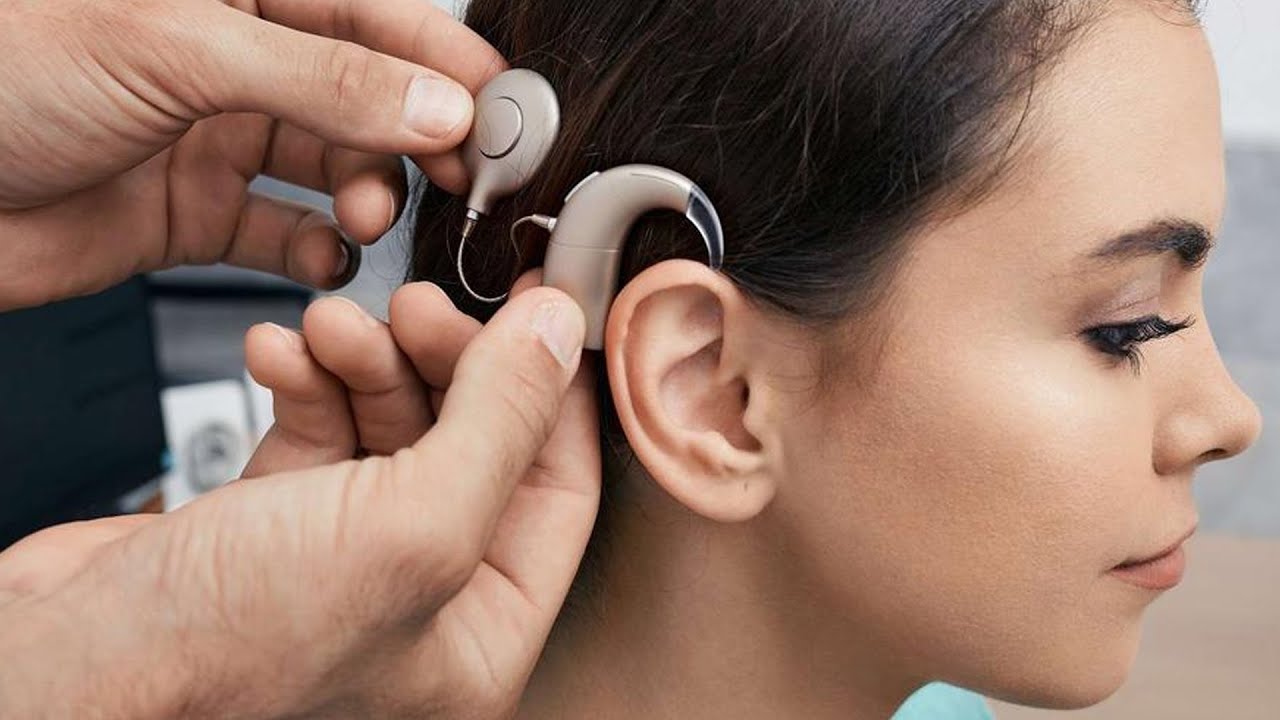 Quels sont les bénéfices et limites de l’implant cochléaire ?