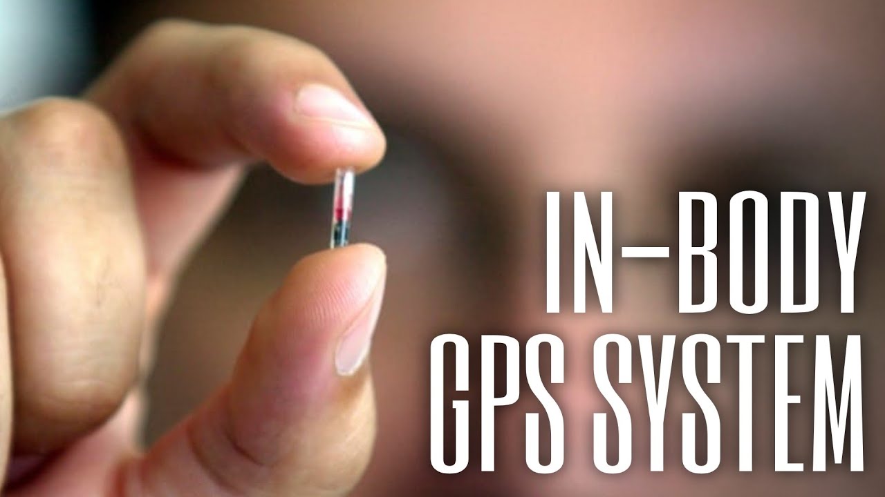 Why an in-body GPS tracker is really useful | ReMix in-body GPS microchip