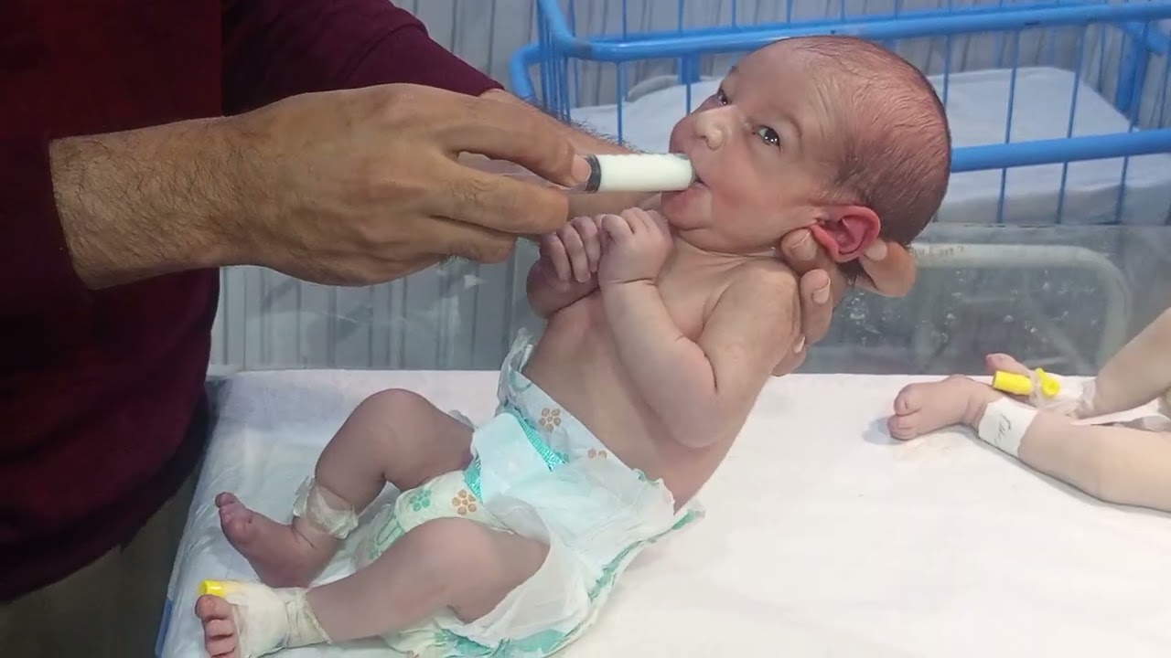 NICU Newborn Baby Syringe Feeding
